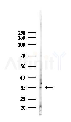 GDNF Receptor alpha 2 Antibody - Western blot analysis of lysates from B16F10-LUC cells(UV,30min treatment), using GDNF Receptor alpha 2 Antibody at 1/1000 dilution.