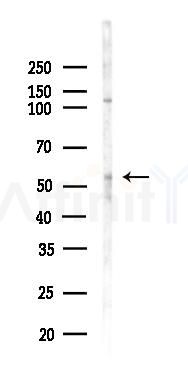 KAT8 Antibody - Western blot analysis of lysates from LoVo cells(heat-shock,45min treatment), using KAT8 Antibody at 1/1000 dilution.
