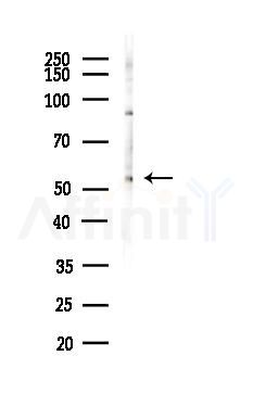 KAT8 Antibody - Western blot analysis of lysates from HUVEC cells(LPS,4h treatment), using KAT8 Antibody at 1/1000 dilution.