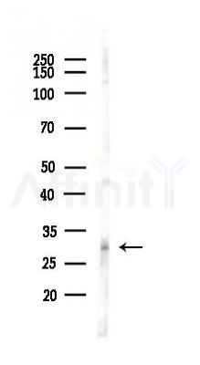 TIGAR Antibody - Western blot analysis of lysates from HUVEC cells(LPS,4h treatment), using TIGAR Antibody at 1/1000 dilution.