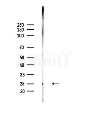 Ribosomal protein L26 Antibody - Western blot analysis of lysates from Mouse testis, using Ribosomal protein L26 Antibody at 1/1000 dilution.