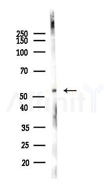 5HT7 Receptor Antibody - Western blot analysis of lysates from HUVEC cells(LPS,4h treatment), using 5HT7 Receptor Antibody at 1/1000 dilution.