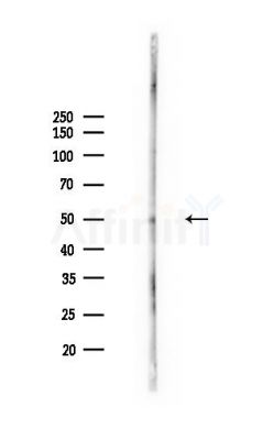 TRP1 Antibody - Western blot analysis of lysates from Rat brain, using TRP1 Antibody at 1/1000 dilution.