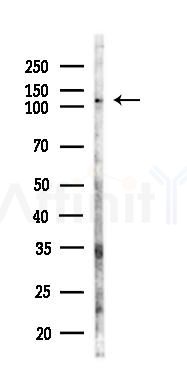 TFII I Antibody - Western blot analysis of lysates from LoVo cells(heat-shock,45min treatment), using TFII I Antibody at 1/1000 dilution.