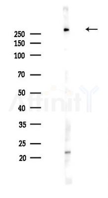 ITPR2 Antibody - Western blot analysis of lysates from PC12 cells(UV,30min treatment), using ITPR2 Antibody at 1/1000 dilution.