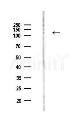 PHF8 Antibody - Western blot analysis of lysates from HUVEC cells(LPS,4h treatment), using PHF8 Antibody at 1/1000 dilution.