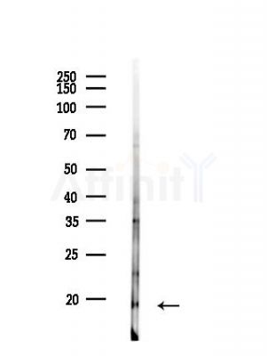 RBM3 Antibody - Western blot analysis of lysates from B16F10-LUC cells, using RBM3 Antibody at 1/1000 dilution.
