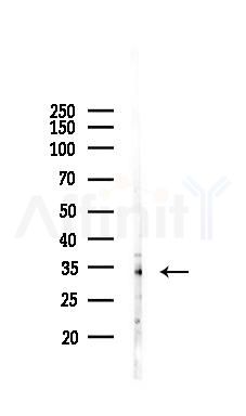 SLC31A1 / CTR1 Antibody - Western blot analysis of lysates from RAW264.