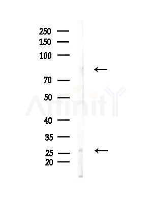 Endomucin Antibody - Western blot analysis of lysates from Mouse muscle, using Endomucin Antibody at 1/1000 dilution.