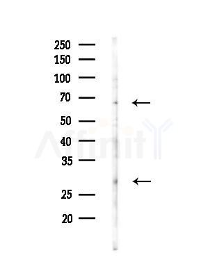 Endomucin Antibody - Western blot analysis of lysates from MDA-MB-231 cells(heat-shock, 45min treatment), using Endomucin Antibody at 1/1000 dilution.
