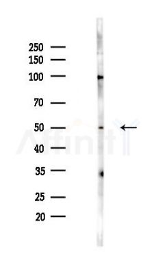 FOXA2 Antibody - Western blot analysis of lysates from PC12 cells(UV,30min treatment), using FOXA2 Antibody at 1/1000 dilution.