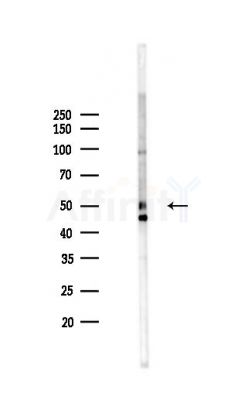 FOXA2 Antibody - Western blot analysis of lysates from Rat brain, using FOXA2 Antibody at 1/1000 dilution.