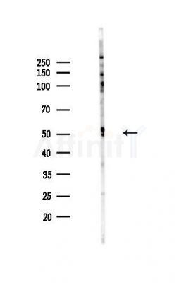 FOXA2 Antibody - Western blot analysis of lysates from HepG2 cells(starvation,24h treatment), using FOXA2 Antibody at 1/1000 dilution.