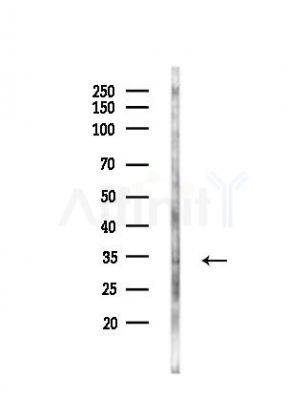XLF Antibody - Western blot analysis of lysates from PC12 cells(UV,30min treatment), using XLF Antibody at 1/1000 dilution.