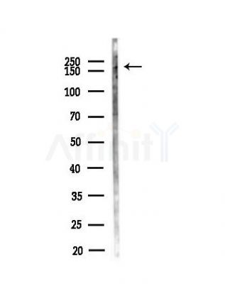 EST1A Antibody - Western blot analysis of lysates from Mouse testis, using EST1A Antibody at 1/1000 dilution.