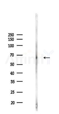 Acid sphingomyelinase Antibody - Western blot analysis of lysates from PC12 cells(starvation,24h treatment), using Acid sphingomyelinase Antibody at 1/1000 dilution.
