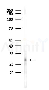 Nociceptin Antibody - Western blot analysis of lysates from HUVEC cells(LPS,4h treatment), using Nociceptin Antibody at 1/1000 dilution.