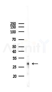 Nociceptin Antibody - Western blot analysis of lysates from PC12 cells, using Nociceptin Antibody at 1/1000 dilution.