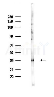 HLA Class I Antibody - Western blot analysis of lysates from PC12 cells(UV,30min treatment), using HLA Class I Antibody at 1/1000 dilution.