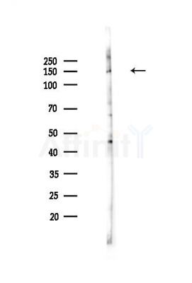 BCL9 Antibody - Western blot analysis of lysates from HepG2 cells(starvation,24h treatment), using BCL9 Antibody at 1/1000 dilution.