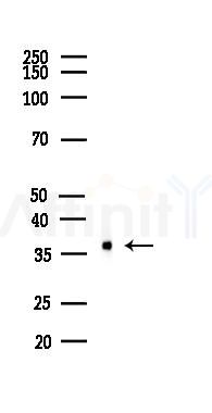AKR1B10 Antibody - Western blot analysis of lysates from HUVEC cells(LPS,4h treatment), using AKR1B10 Antibody at 1/1000 dilution.
