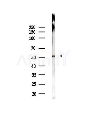 Factor VII Antibody - Western blot analysis of lysates from Rat lung, using Factor VII Antibody at 1/1000 dilution.