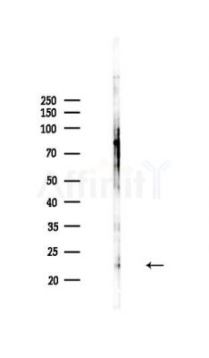 PR3 Antibody - Western blot analysis of lysates from MDA-MB-231 cells(heat-shock,45min treatment), using PR3 Antibody at 1/1000 dilution.