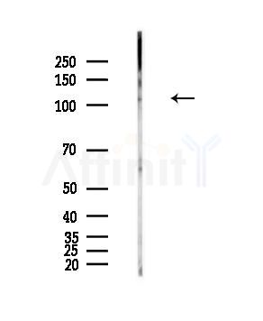 NLRC3 Antibody - Western blot analysis of lysates from PC12 cells(LPS,4h treatment), using NLRC3 Antibody at 1/1000 dilution.