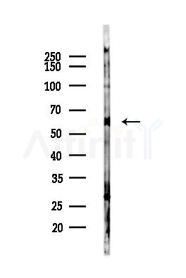 TBLR1 Antibody - Western blot analysis of lysates from Mouse testis, using TBLR1 Antibody at 1/1000 dilution.