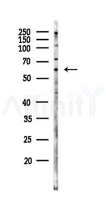 LYRIC Antibody - Western blot analysis of lysates from LoVo cells(heat-shock,45min treatment), using LYRIC Antibody at 1/1000 dilution.