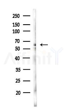 LYRIC Antibody - Western blot analysis of lysates from Mouse testis, using LYRIC Antibody at 1/1000 dilution.