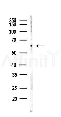 LYRIC Antibody - Western blot analysis of lysates from HUVEC cells(LPS,4h treatment), using LYRIC Antibody at 1/1000 dilution.