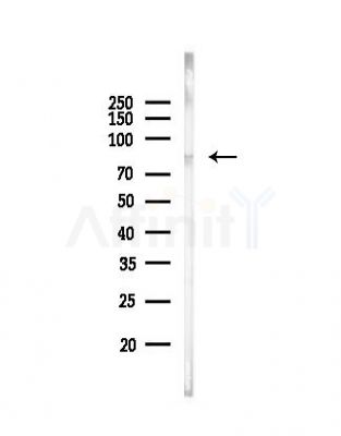 LOXL2 Antibody - Western blot analysis of lysates from A549 cells, using LOXL2 Antibody at 1/1000 dilution.