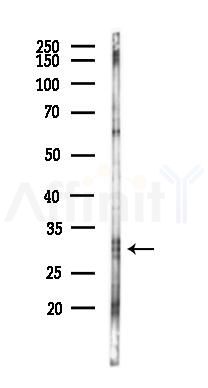 Slap Antibody - Western blot analysis of lysates from HUVEC cells(LPS,4h treatment), using Slap Antibody at 1/1000 dilution.