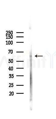 STAM1 Antibody - Western blot analysis of lysates from 293 cells(UV,30min treatment), using STAM1 Antibody at 1/1000 dilution.