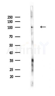 KCNQ2 Antibody - Western blot analysis of lysates from PC12 cells(UV,30min treatment), using KCNQ2 Antibody at 1/1000 dilution.