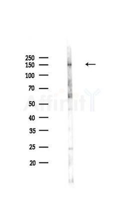 Niemann Pick C1 Antibody - Western blot analysis of lysates from Rat brain, using Niemann Pick C1 Antibody at 1/1000 dilution.