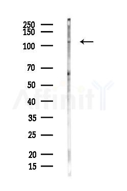 ITIH2 Antibody - Western blot analysis of lysates from Hela cells(heat-shock,45min treatment), using ITIH2 Antibody at 1/1000 dilution.