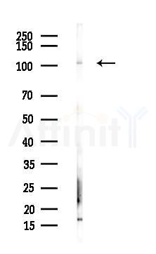 PSMD1 Antibody - Western blot analysis of lysates from Hela cells(heat-shock,45min treatment), using PSMD1 Antibody at 1/1000 dilution.