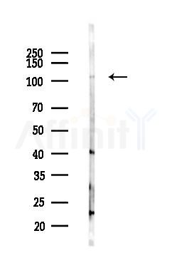 Kinesin 5A Antibody - Western blot analysis of lysates from Mouse liver, using Kinesin 5A Antibody at 1/1000 dilution.