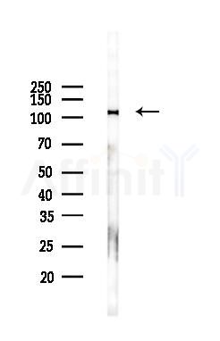 Kinesin 5A Antibody - Western blot analysis of lysates from COLO205 cells(LPS, 4h treatment), using Kinesin 5A Antibody at 1/1000 dilution.