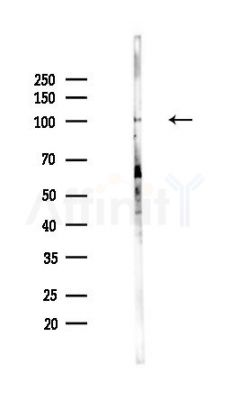 HIRA Antibody - Western blot analysis of lysates from PC12 cells(UV,30min treatment), using HIRA Antibody at 1/1000 dilution.