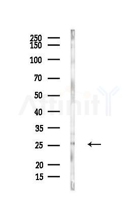 AK2 Antibody - Western blot analysis of lysates from Hela cells(heat-shock,45min treatment), using AK2 Antibody at 1/1000 dilution.