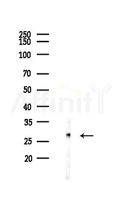 AK2 Antibody - Western blot analysis of lysates from Mouse liver, using AK2 Antibody at 1/1000 dilution.