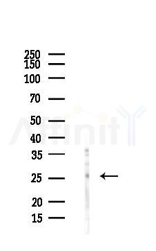 AK2 Antibody - Western blot analysis of lysates from COLO205 cells(LPS, 4h treatment), using AK2 Antibody at 1/1000 dilution.