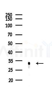 FHL1 Antibody - Western blot analysis of lysates from EC304 cells(UV, 30min treatment), using FHL1 Antibody at 1/1000 dilution.