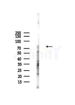 CPEB4 Antibody - Western blot analysis of lysates from Hela cells(heat-shock,45min treatment), using CPEB4 Antibody at 1/1000 dilution.