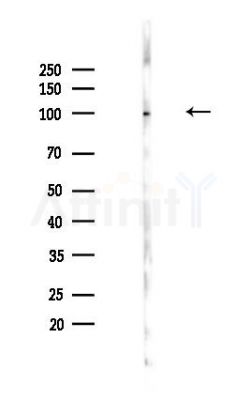 p90 Autoantigen Antibody - Western blot analysis of lysates from PC12 cells(UV,30min treatment), using p90 Autoantigen Antibody at 1/1000 dilution.