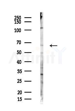 BIN1 Antibody - Western blot analysis of lysates from Hela cells(heat-shock,45min treatment), using BIN1 Antibody at 1/1000 dilution.