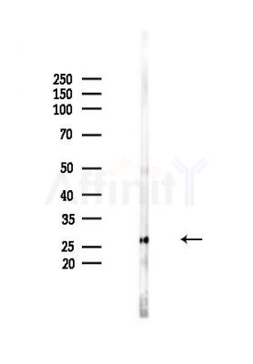 NAT14 Antibody - Western blot analysis of lysates from Mouse brain, using NAT14 Antibody at 1/1000 dilution.